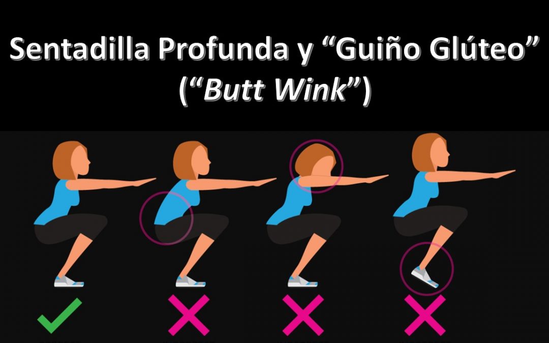 Sentadilla Profunda y Guiño Glúteo (“Butt Wink”)